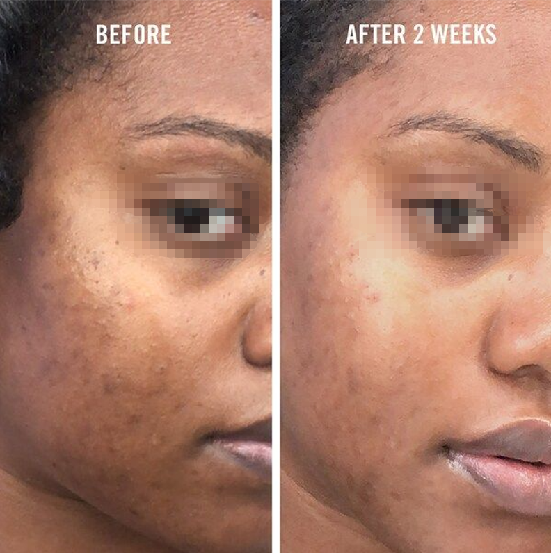 before-and-after-gallery-10