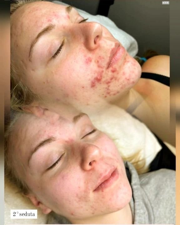 before-and-after-gallery-11