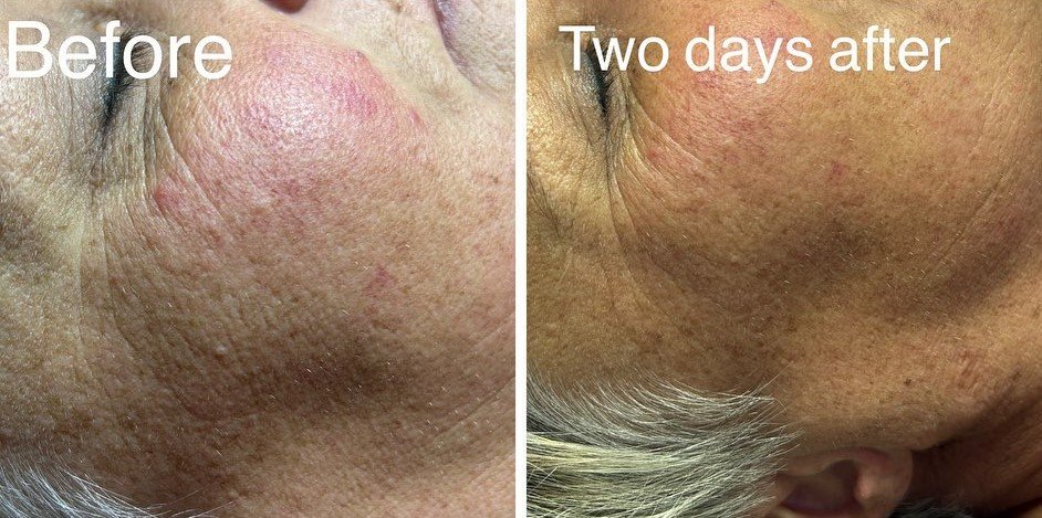 before-and-after-gallery-12