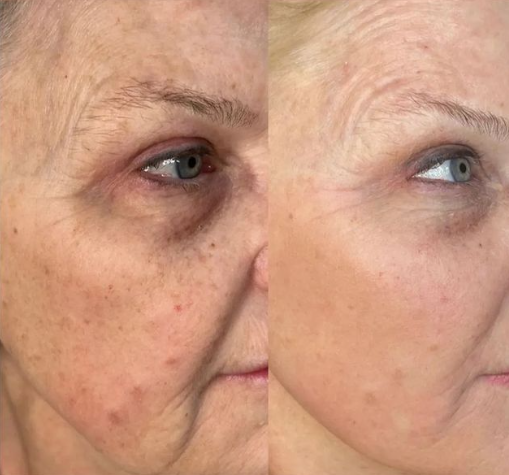 before-and-after-gallery-2