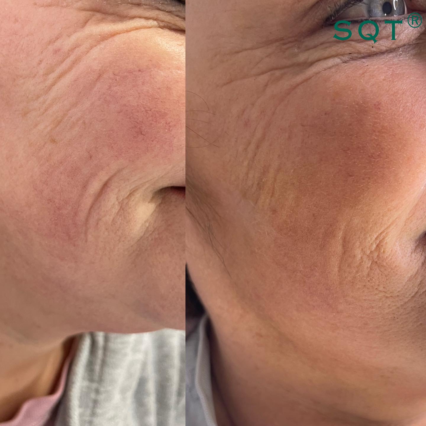 before-and-after-gallery-3