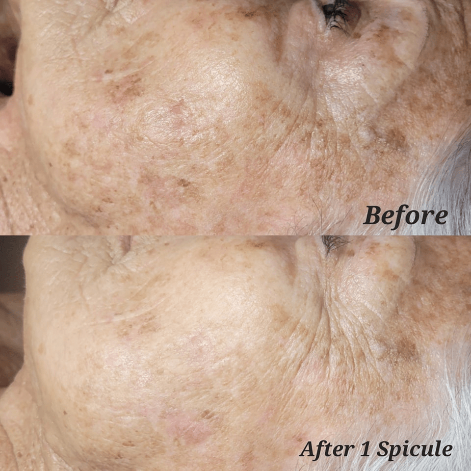 before-and-after-gallery-4