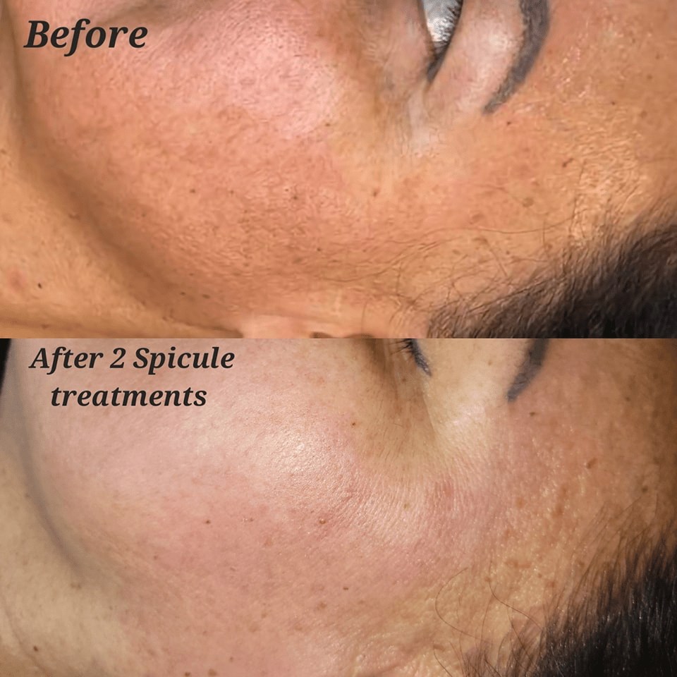 before-and-after-gallery-5