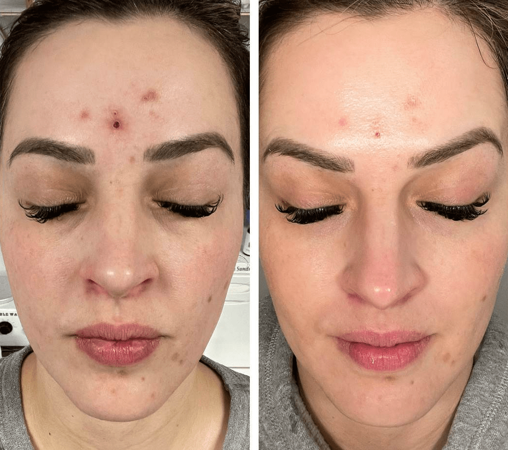 before-and-after-gallery-6