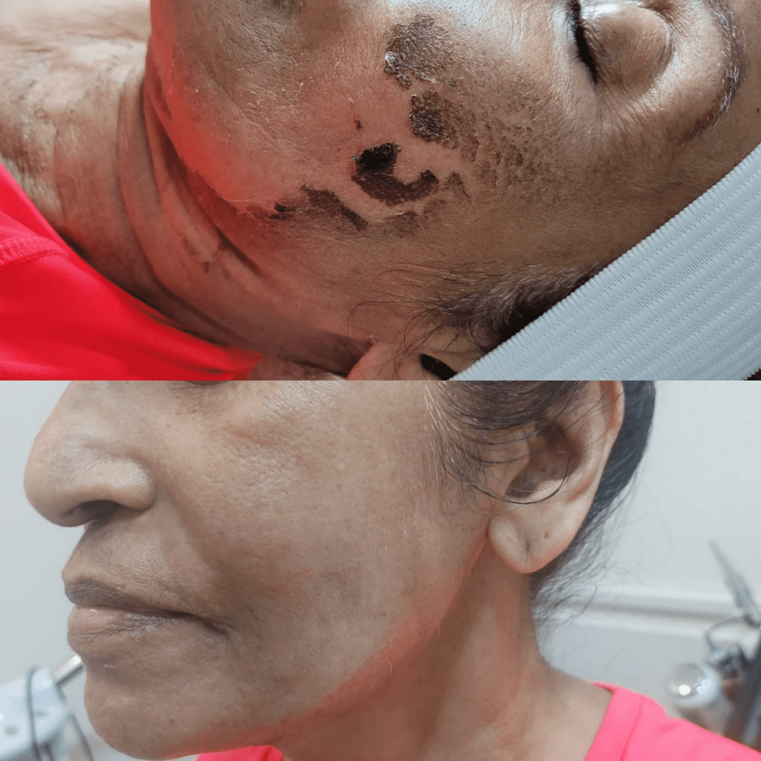 before-and-after-gallery-7