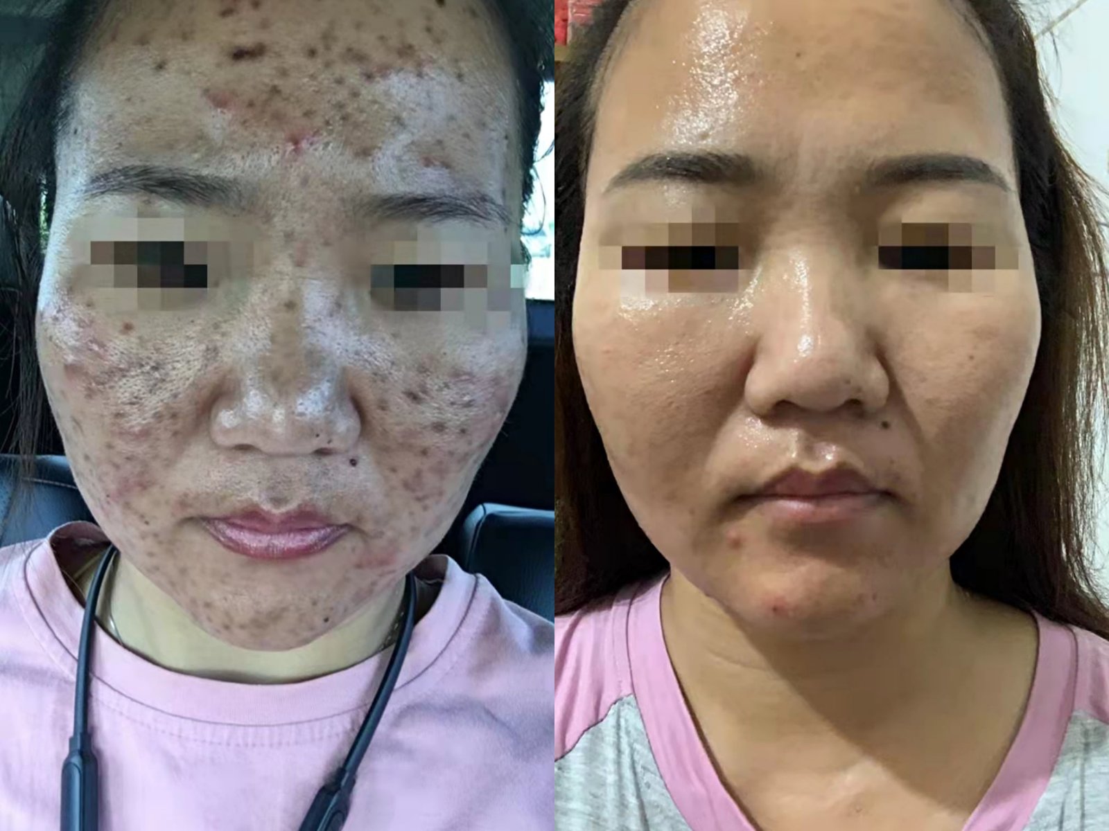 before-and-after-gallery-8