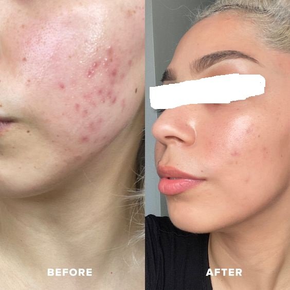 before-and-after-gallery-9